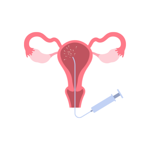 التلقيح الصناعي و الحقن المجهري