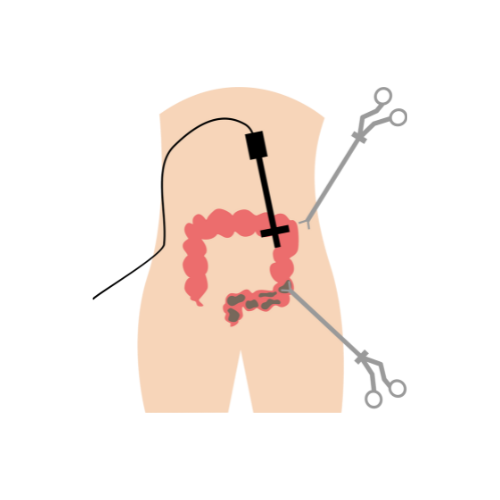 جراحة مناظير بالغين