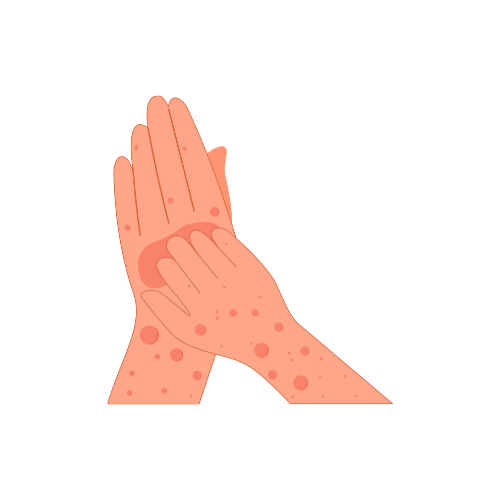 علاج حساسية الجلد